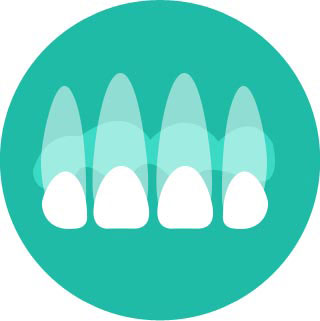 Loose or lost filling, crown or veneer
