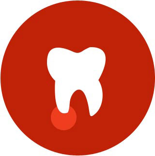 Root Canal Treatment (Endodontics)