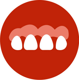 Swollen, Bleeding Gums (Gingivitis)